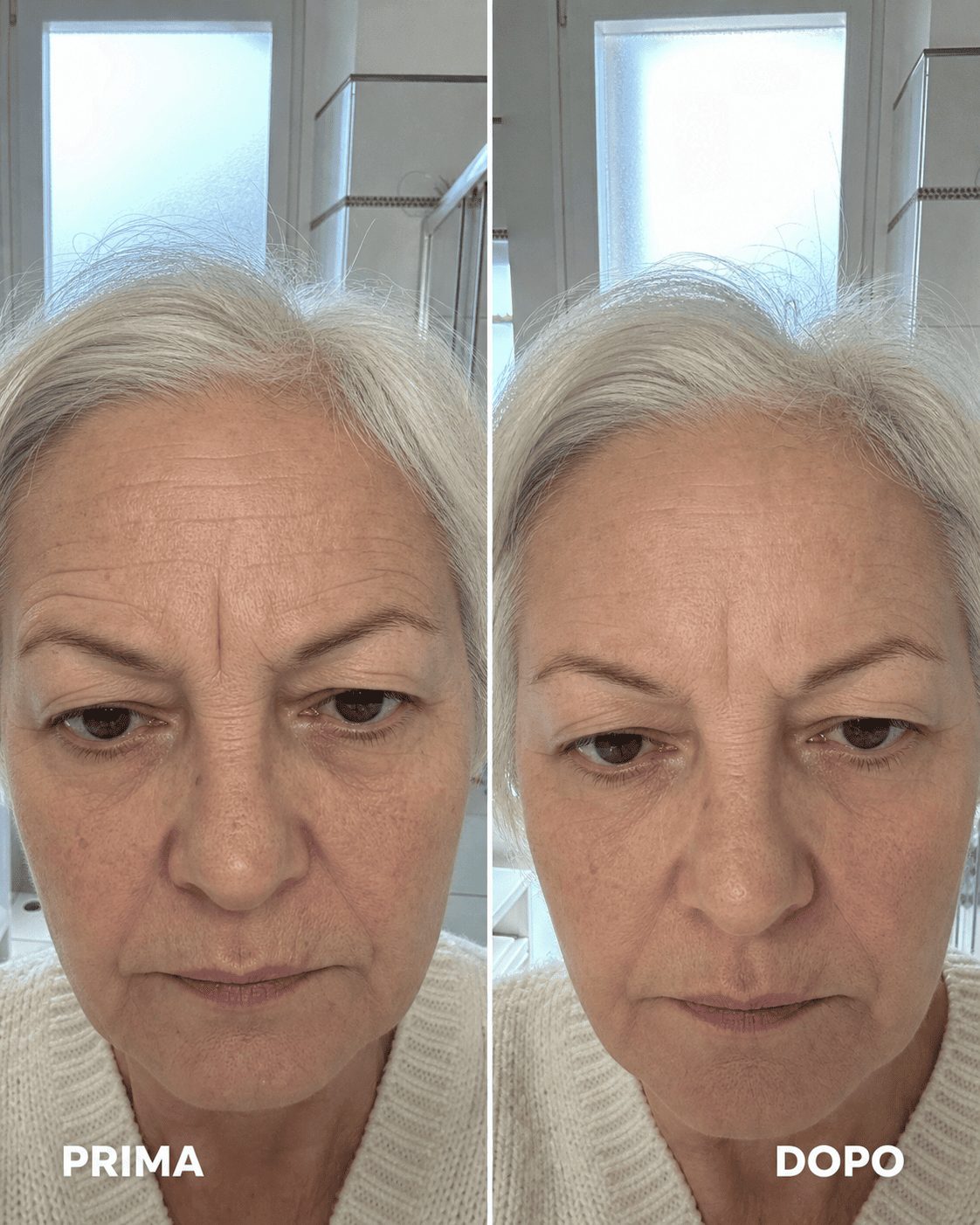 Prima e dopo