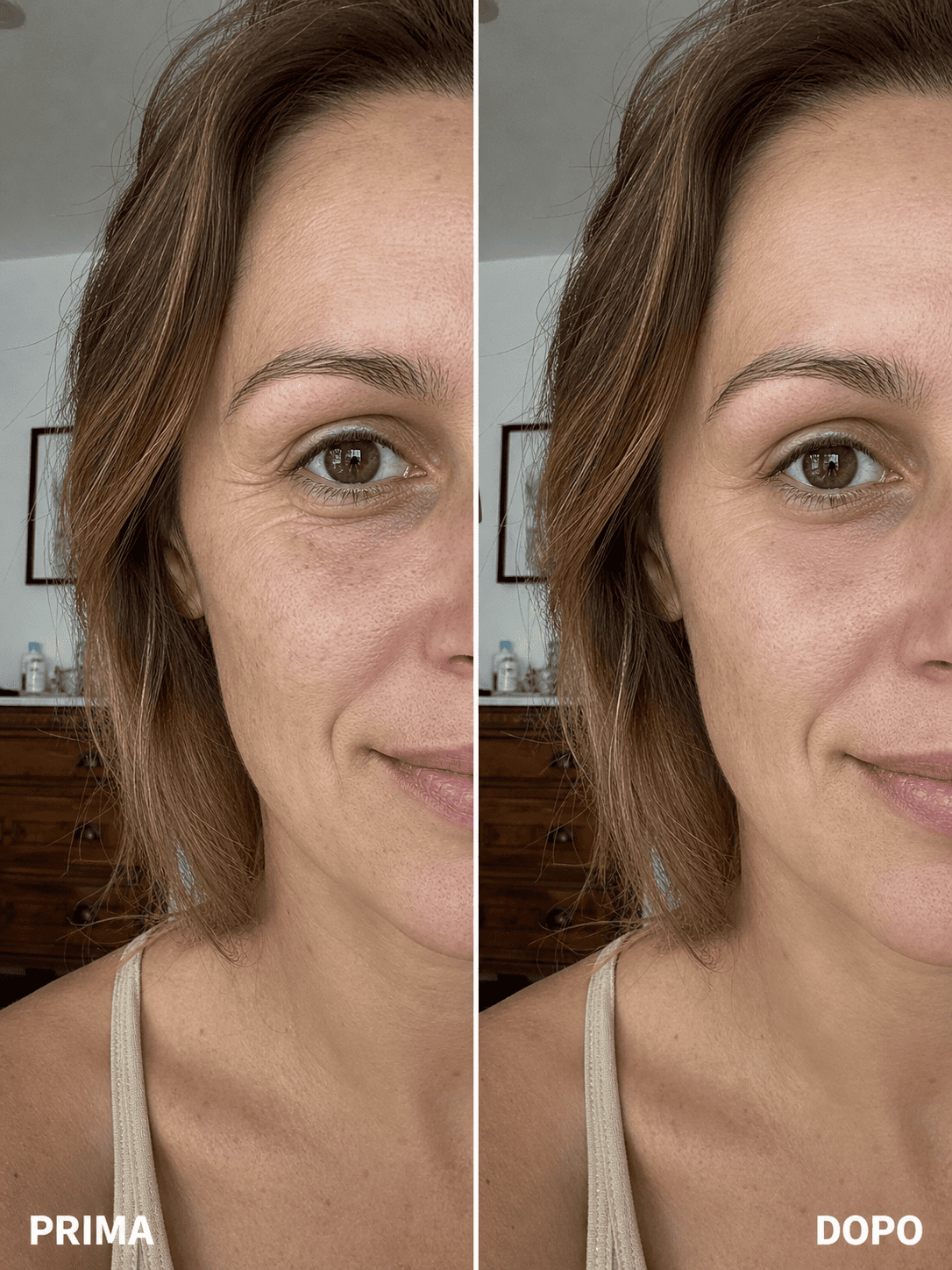 Prima e dopo