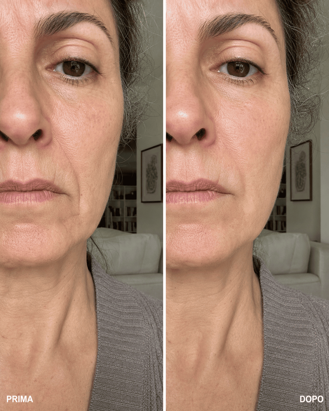 Prima e dopo